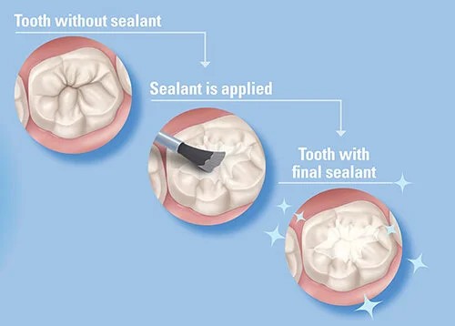 Image credit: Centers for Disease Control and Prevention