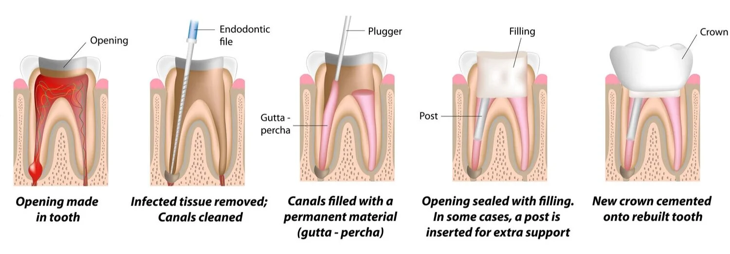 Image credit: Keith S. Tang, DDS