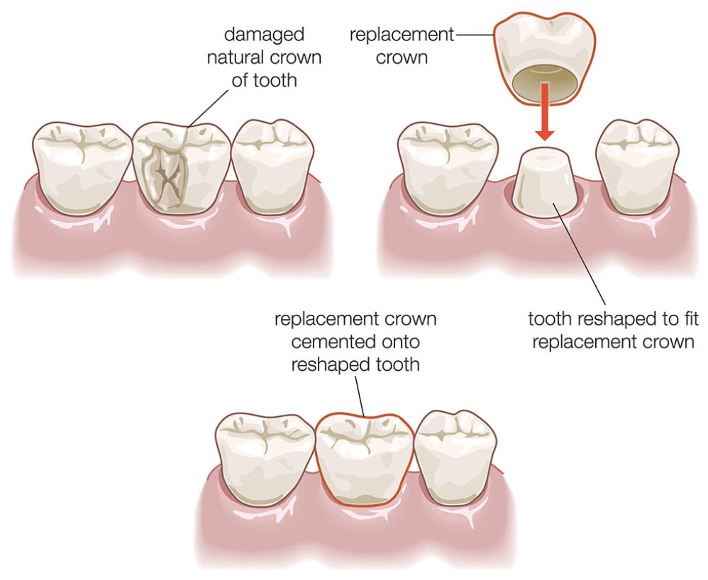 Image Credit: healthdirect